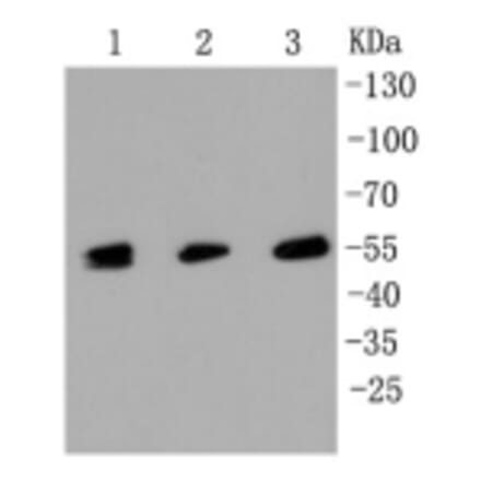 Anti-MLKL Antibody from Bioworld Technology (BS9822M) - Antibodies.com