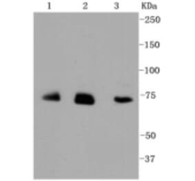 Anti-ALAS1 Antibody from Bioworld Technology (BS9823M) - Antibodies.com