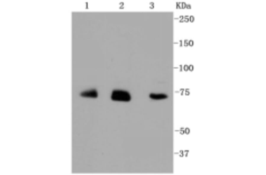 Anti-ALAS1 Antibody from Bioworld Technology (BS9823M) - Antibodies.com