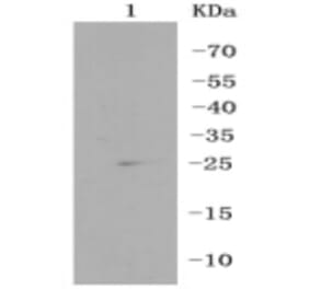 Anti-RPS3 Antibody from Bioworld Technology (BS9824M) - Antibodies.com