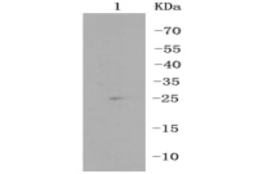 Anti-RPS3 Antibody from Bioworld Technology (BS9824M) - Antibodies.com