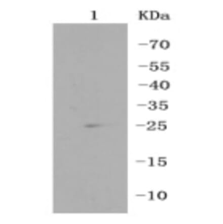 Anti-RPS3 Antibody from Bioworld Technology (BS9824M) - Antibodies.com