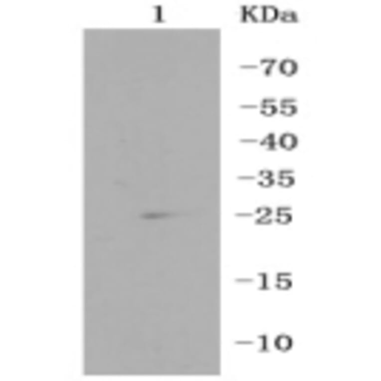 Anti-RPS3 Antibody from Bioworld Technology (BS9824M) - Antibodies.com