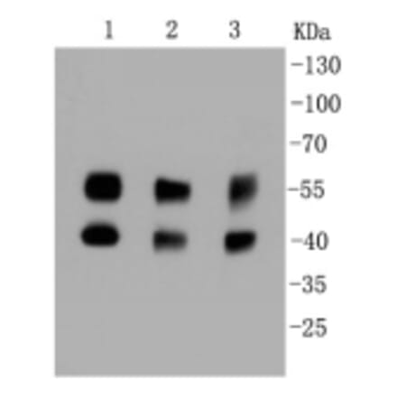 Anti-JNK1/2/3 Antibody from Bioworld Technology (BS9825M) - Antibodies.com