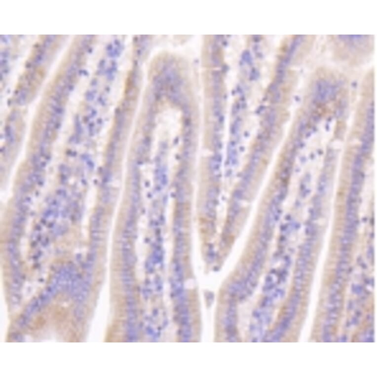 Anti-Catenin-β Antibody from Bioworld Technology (BS9828M) - Antibodies.com
