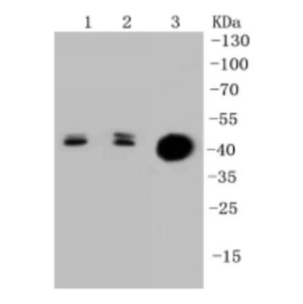 Anti-Cytokeratin 20 Antibody from Bioworld Technology (BS9831M) - Antibodies.com