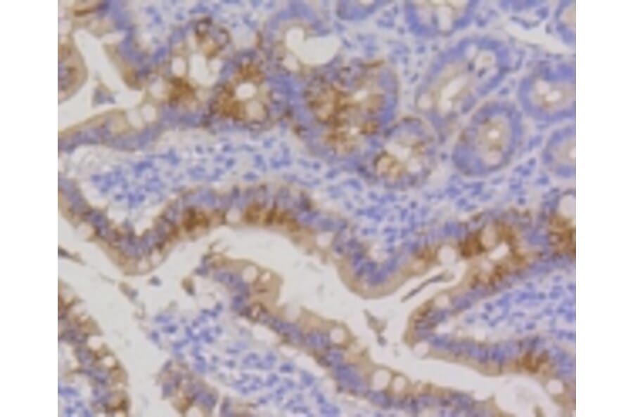Anti-Cytokeratin 20 Antibody from Bioworld Technology (BS9831M) - Antibodies.com