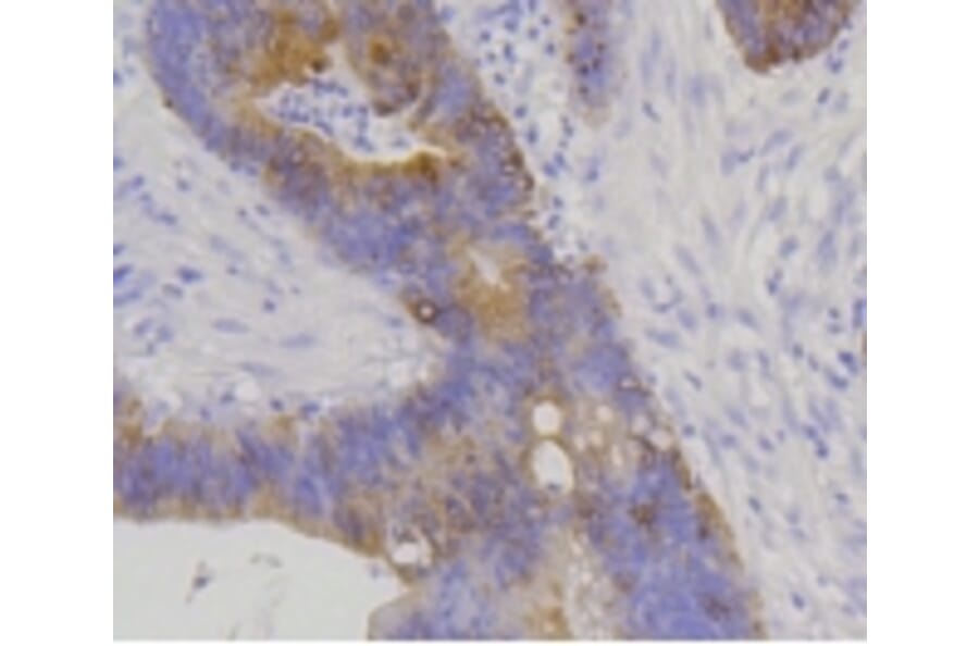 Anti-Cytokeratin 20 Antibody from Bioworld Technology (BS9831M) - Antibodies.com