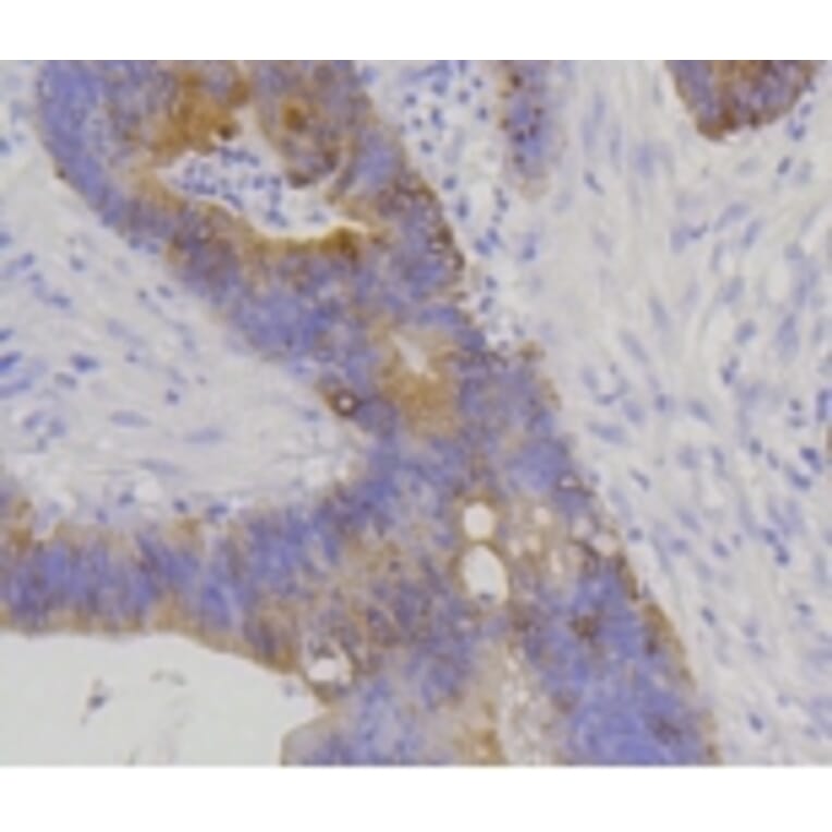 Anti-Cytokeratin 20 Antibody from Bioworld Technology (BS9831M) - Antibodies.com