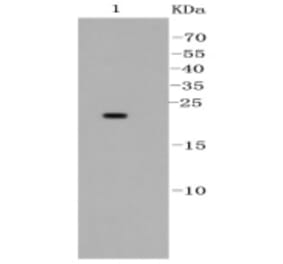 Anti-Bad Antibody from Bioworld Technology (BS9832M) - Antibodies.com