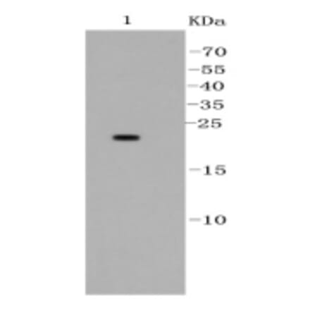 Anti-Bad Antibody from Bioworld Technology (BS9832M) - Antibodies.com