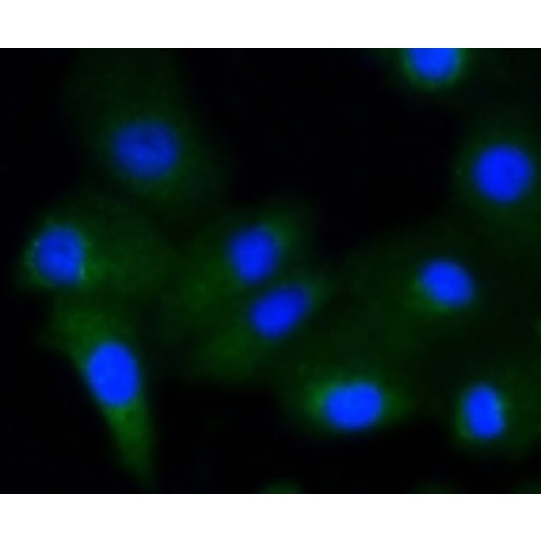 Anti-GYS1 (phospho-S641) Antibody from Bioworld Technology (BS9838M) - Antibodies.com