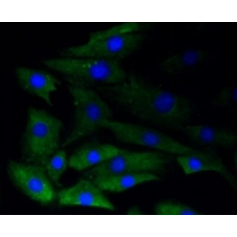 Anti-GYS1 (phospho-S641) Antibody from Bioworld Technology (BS9838M) - Antibodies.com