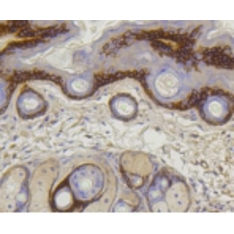 Anti-COL17A1 Antibody from Bioworld Technology (BS9839M) - Antibodies.com