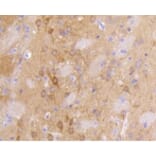 Anti-PSD-95 Antibody from Bioworld Technology (BS9845M) - Antibodies.com
