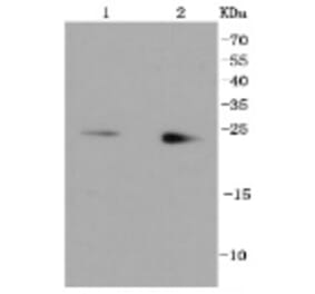 Anti-Rab9 Antibody from Bioworld Technology (BS9854M) - Antibodies.com