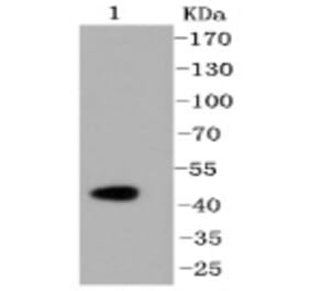 Anti-Caspase-2 Antibody from Bioworld Technology (BS9856M) - Antibodies.com