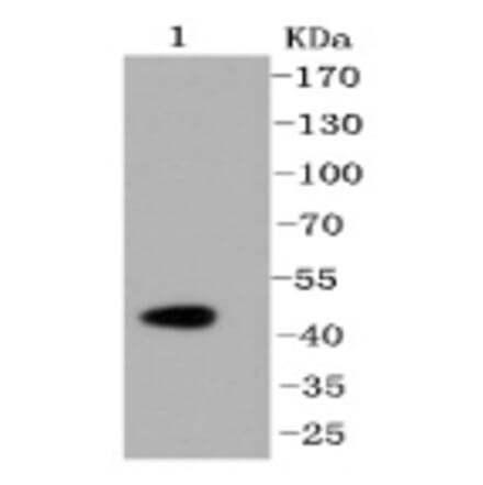 Anti-Caspase-2 Antibody from Bioworld Technology (BS9856M) - Antibodies.com