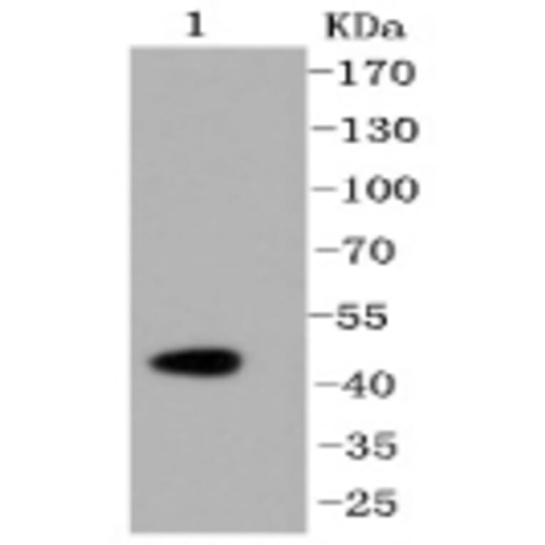 Anti-Caspase-2 Antibody from Bioworld Technology (BS9856M) - Antibodies.com