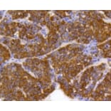 Anti-PHB Antibody from Bioworld Technology (BS9857M) - Antibodies.com