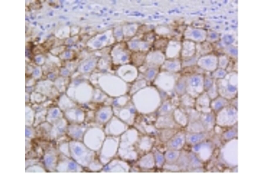 Anti-SCARB1 Antibody from Bioworld Technology (BS9858M) - Antibodies.com