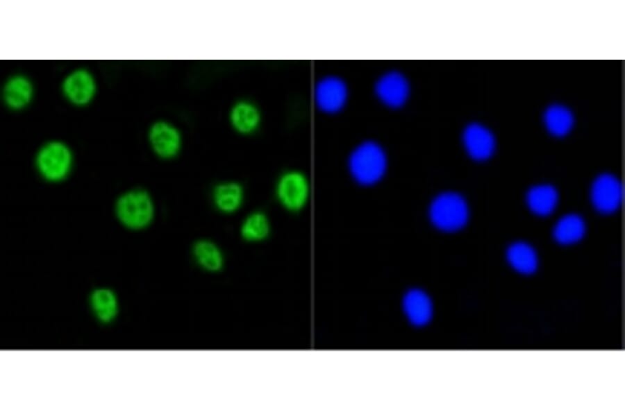 Anti-Histone H2A (Acetyl-K9) Antibody from Bioworld Technology (BS9860M) - Antibodies.com