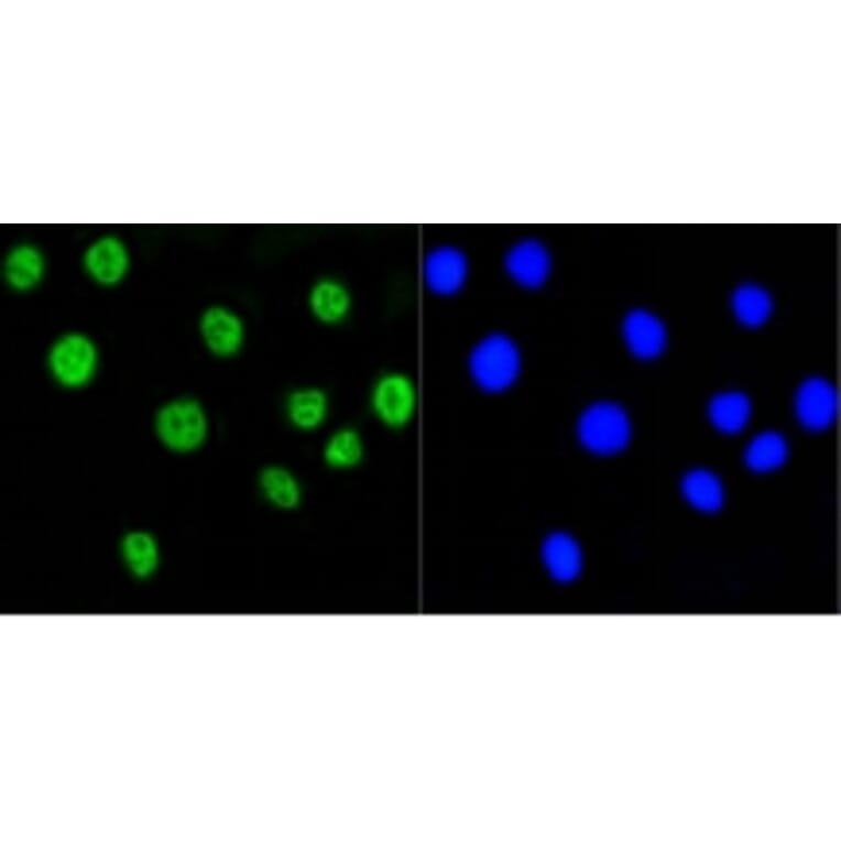 Anti-Histone H2A (Acetyl-K9) Antibody from Bioworld Technology (BS9860M) - Antibodies.com