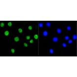 Anti-Histone H2A (Acetyl-K9) Antibody from Bioworld Technology (BS9860M) - Antibodies.com