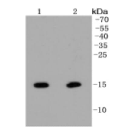 Anti-Histone H2A (Hydroxyl-Y39) Antibody from Bioworld Technology (BS9861M) - Antibodies.com