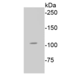 Anti-Rb (phospho-S807) Antibody from Bioworld Technology (BS9862M) - Antibodies.com