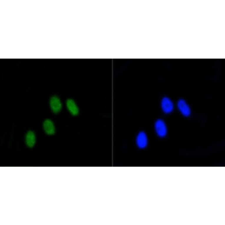 Anti-Rb (phospho-S807) Antibody from Bioworld Technology (BS9862M) - Antibodies.com