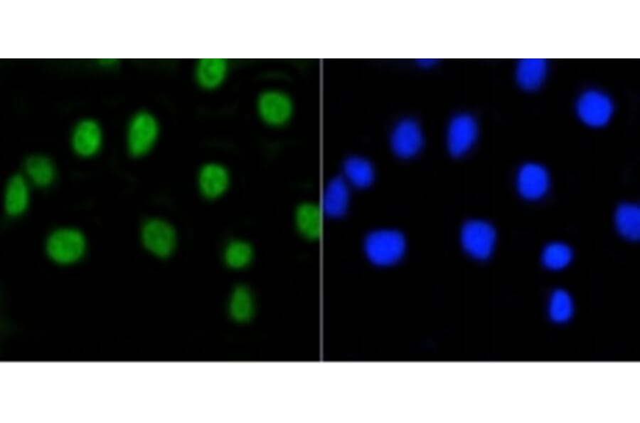 Anti-Rb (phospho-S807) Antibody from Bioworld Technology (BS9862M) - Antibodies.com