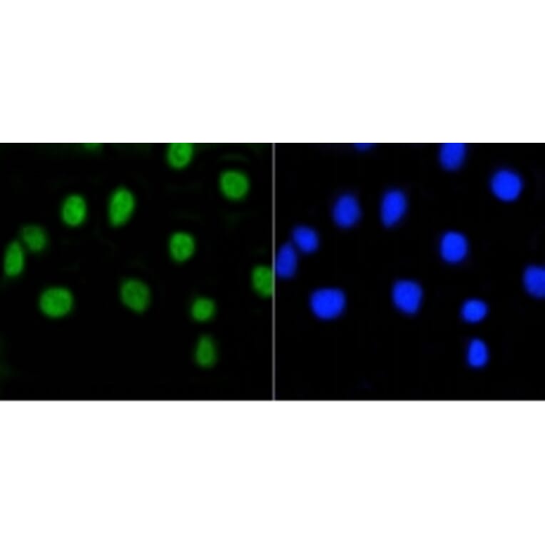 Anti-Rb (phospho-S807) Antibody from Bioworld Technology (BS9862M) - Antibodies.com