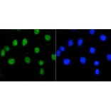 Anti-Rb (phospho-S807) Antibody from Bioworld Technology (BS9862M) - Antibodies.com