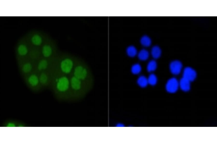 Anti-Rb (phospho-S807) Antibody from Bioworld Technology (BS9862M) - Antibodies.com