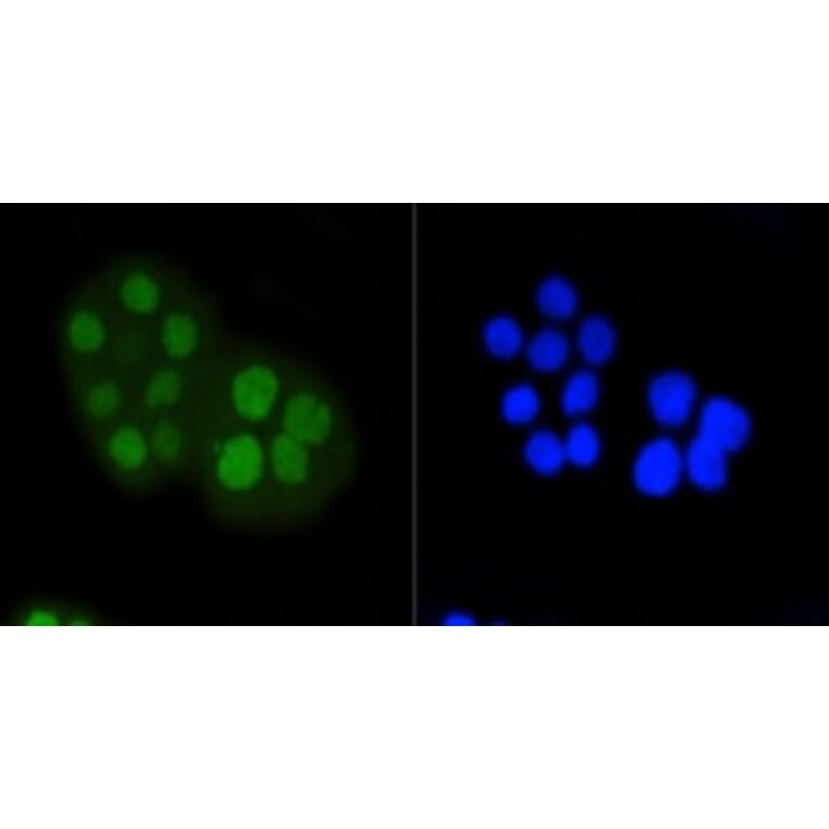 Anti-Rb (phospho-S807) Antibody from Bioworld Technology (BS9862M) - Antibodies.com