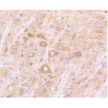 Anti-IFN-R1 Antibody from Bioworld Technology (BS9863M) - Antibodies.com