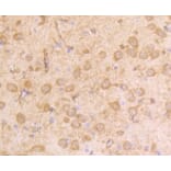 Anti-IFN-R1 Antibody from Bioworld Technology (BS9863M) - Antibodies.com