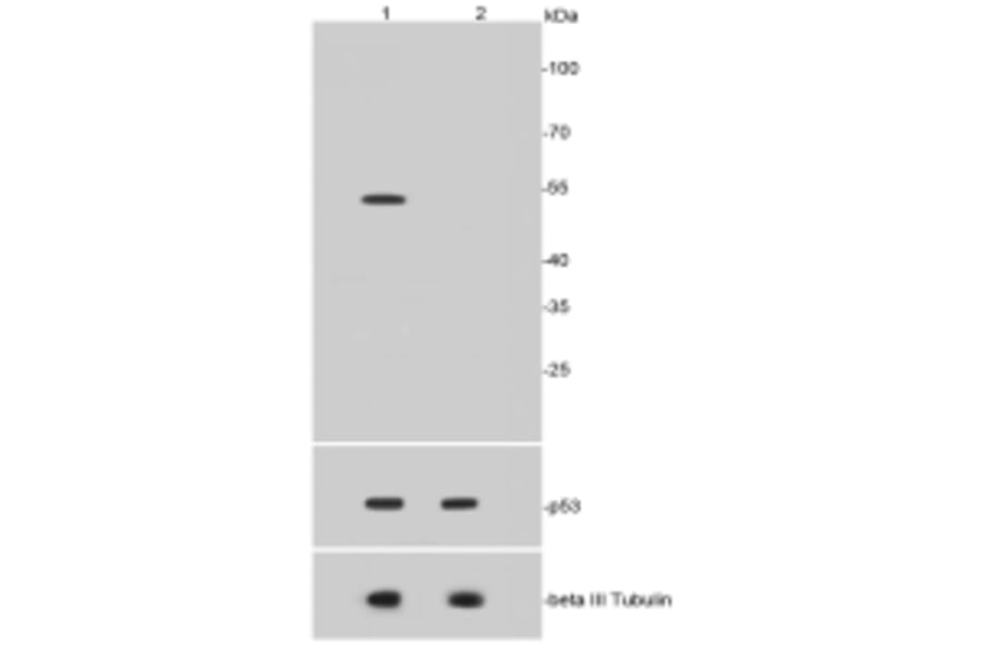 Anti-p53 (Acetyl-K370) Antibody from Bioworld Technology (BS9864M) - Antibodies.com