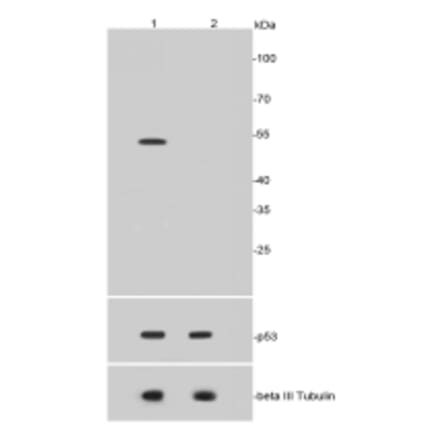 Anti-p53 (Acetyl-K370) Antibody from Bioworld Technology (BS9864M) - Antibodies.com