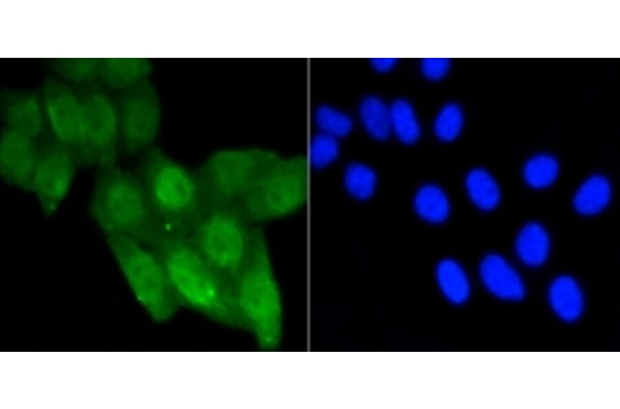 Anti-p53 (Acetyl-K370) Antibody from Bioworld Technology (BS9864M) - Antibodies.com