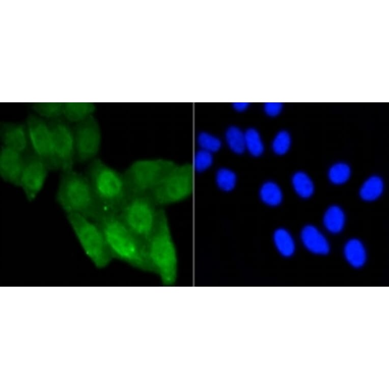 Anti-p53 (Acetyl-K370) Antibody from Bioworld Technology (BS9864M) - Antibodies.com