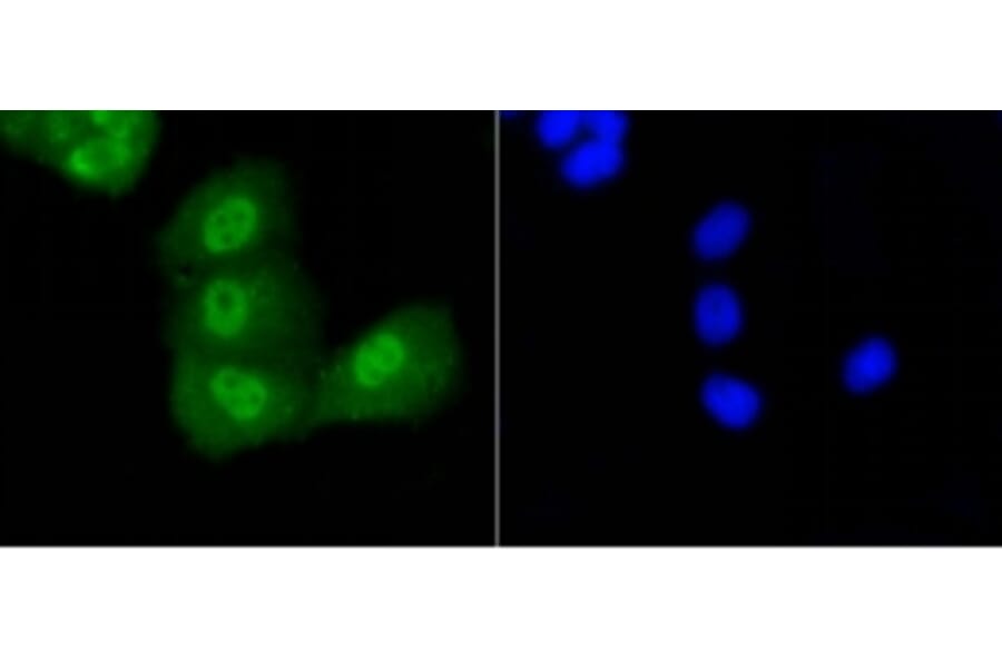 Anti-p53 (Acetyl-K370) Antibody from Bioworld Technology (BS9864M) - Antibodies.com