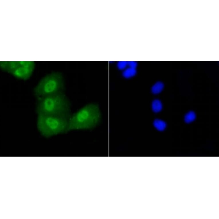 Anti-p53 (Acetyl-K370) Antibody from Bioworld Technology (BS9864M) - Antibodies.com