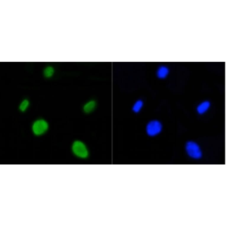 Anti-Histone H4 (Acetyl-K5) Antibody from Bioworld Technology (BS9867M) - Antibodies.com