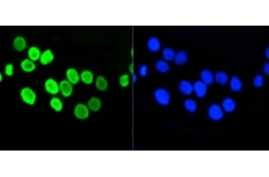 Anti-Histone H4 (Acetyl-K5) Antibody from Bioworld Technology (BS9867M) - Antibodies.com
