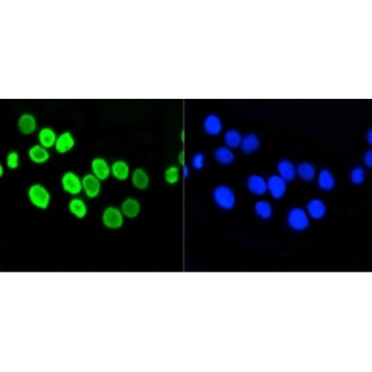 Anti-Histone H4 (Acetyl-K5) Antibody from Bioworld Technology (BS9867M) - Antibodies.com