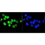 Anti-Histone H4 (Acetyl-K5) Antibody from Bioworld Technology (BS9867M) - Antibodies.com