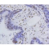 Anti-Histone H4 (Acetyl-K5) Antibody from Bioworld Technology (BS9867M) - Antibodies.com