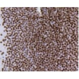 Anti-Histone H4 (Acetyl-K5) Antibody from Bioworld Technology (BS9867M) - Antibodies.com
